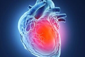Tuổi Thọ Của Người Nghiện Ma Túy Đá Sự Thật Đáng Báo Động 3 Biến chứng tim mạch và đột tử