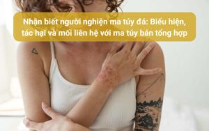 Nhận biết người nghiện ma túy đá Biểu hiện, tác hại và mối liên hệ với ma túy bán tổng hợp