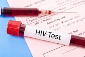 Chơi ma túy đá có bị HIV không? Sự thật cần biết để bảo vệ sức khỏe 6 Xét nghiệm HIV định kỳ