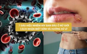 7 dấu hiệu nhiễm HIV ban đầu ở nữ giới