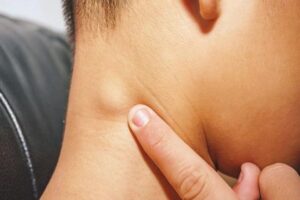 Triệu chứng HIV Dấu hiệu nhận biết sớm và giai đoạn tiến triển 2 Giai đoạn 1 Giai đoạn nhiễm HIV cấp tính