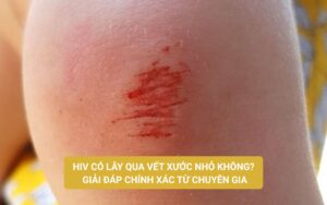 HIV có lây qua vết xước nhỏ không