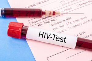 7 dấu hiệu nhiễm HIV ban đầu ở nữ giới 4 Khi nào cần xét nghiệm HIV