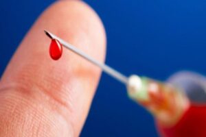 HIV lây qua đường nào? Giải đáp chi tiết các con đường lây truyền phổ biến nhất 2 Lây qua đường máu