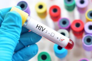 Mục tiêu điều trị HIV hiện nay