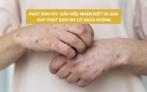 Phát ban HIV
