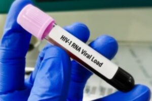 HIV ủ bệnh bao lâu? Dấu hiệu nhận biết và giai đoạn phát triển của virus 5 Xét nghiệm RNA HIV (PCR)